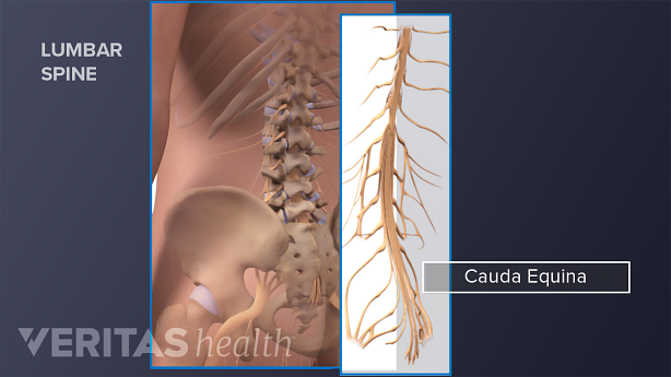 Cauda equina nerves in the lumbar spine.