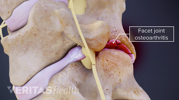3D image of cervical spine.