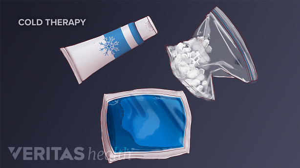 An illustration showing different ice packs.