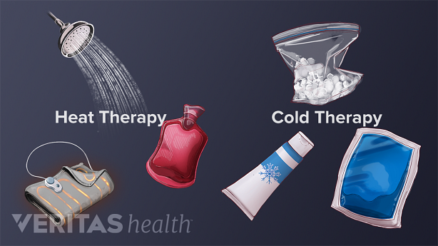 An illustration showing different heat and cold therapy.