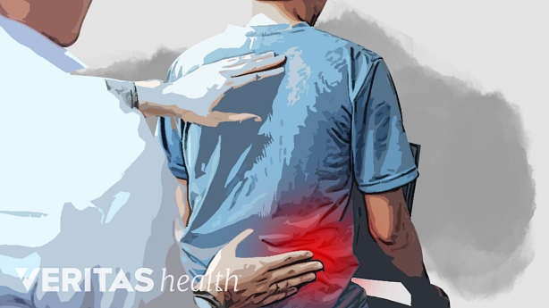 An illustration showing a doctor examining a patient for back pain.