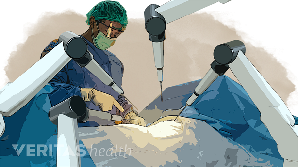 An illustration showing a doctor performing surgery in the operating room.
