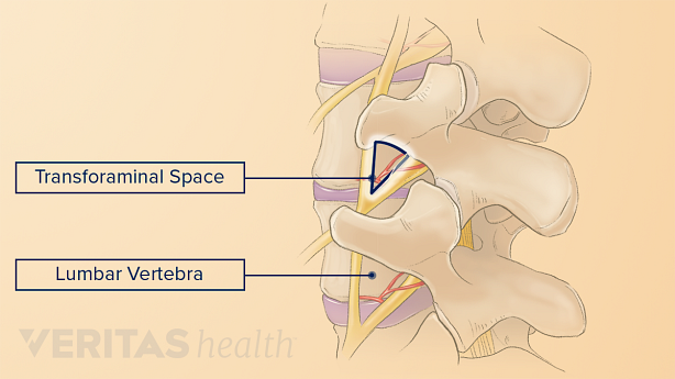 Profile view highlighting the transforaminal space in between vertebrae.