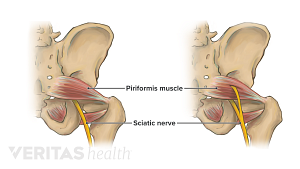 Posterior view of the pelvis labeling piriformis muscle and sciatic nerve.