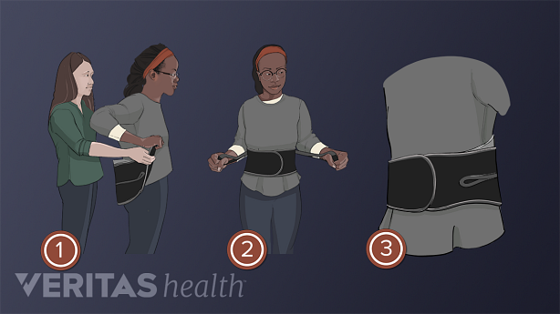 Medical illustration of 3 steps on how to put on a back brace