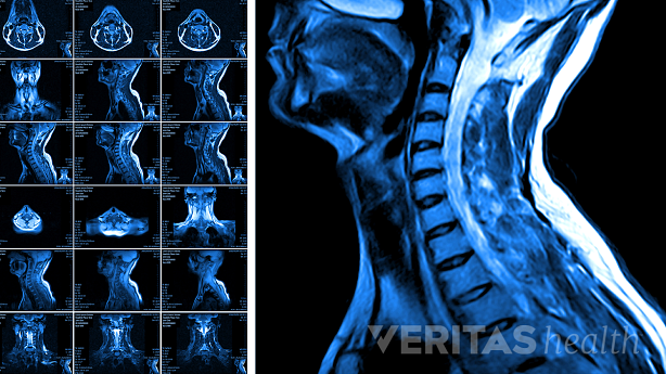 MRI of head and neck region.